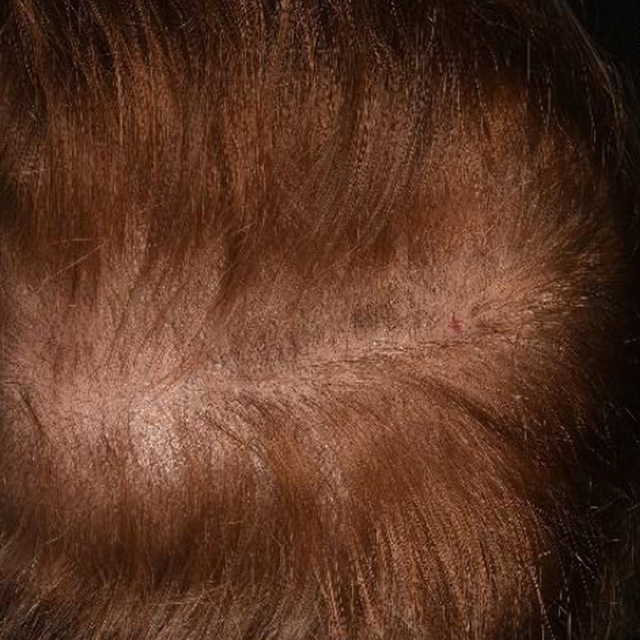 Sérum Cuir chevelu et Cheveux, Avant