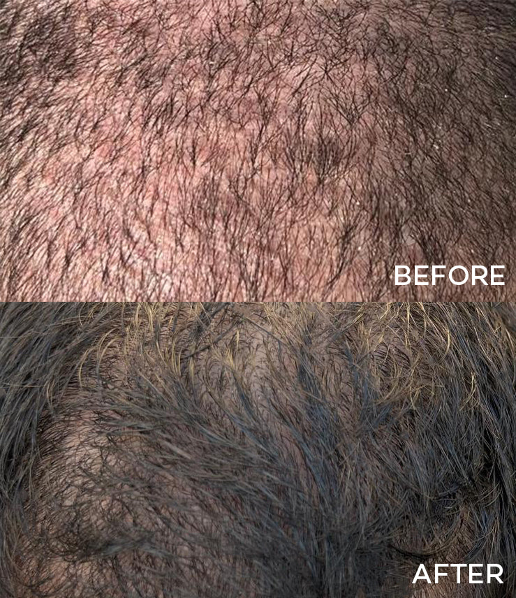 Hair & Scalp Serum